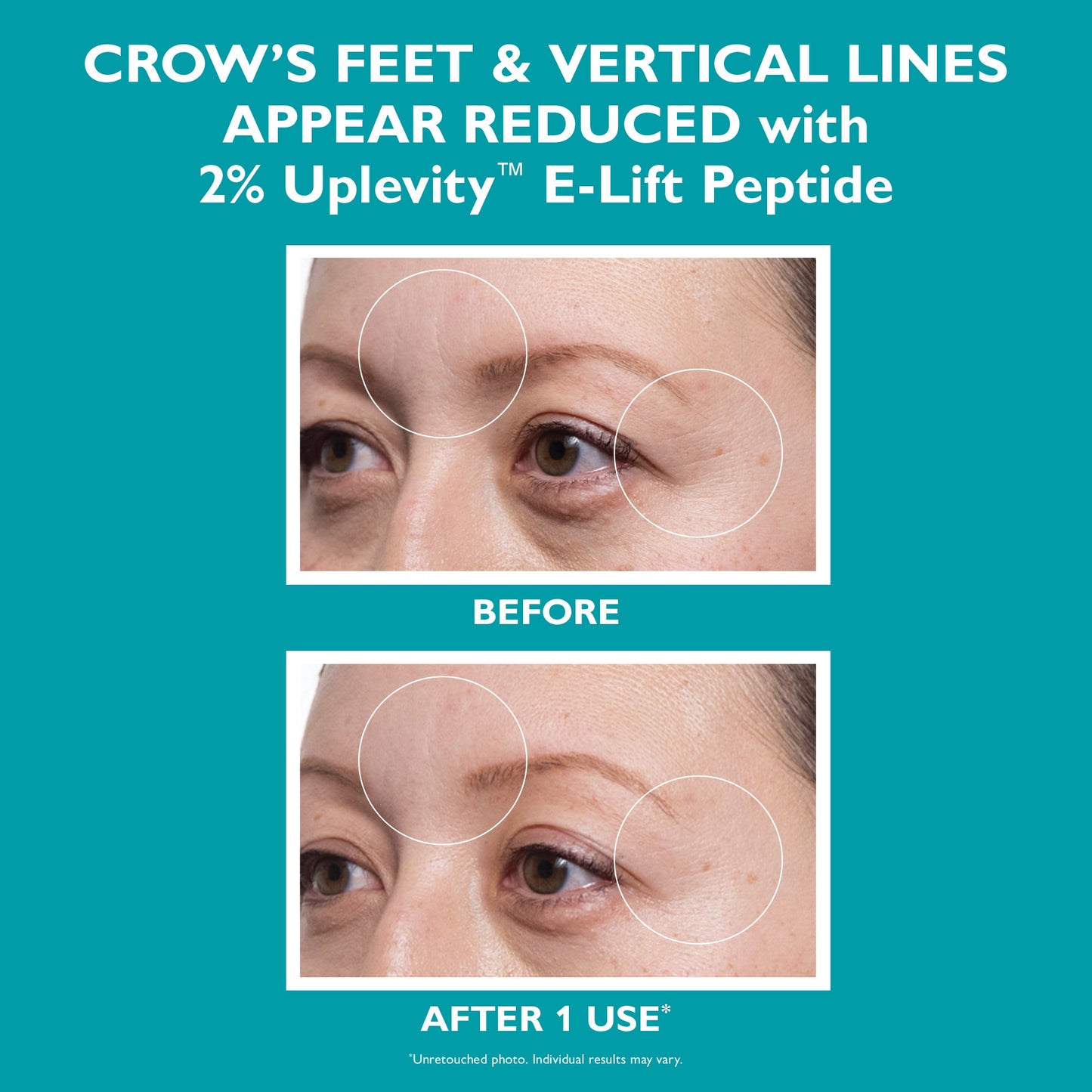 Peptide Skinjection Expression Line Hydra-Gel Patches